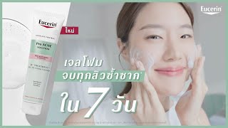 ใหม่ เจลโฟมจบทุกสิวซ้ำซากใน 7 วัน EUCERIN 3X TREATMENT GEL TO FOAM CLEANSER [upl. by Ayekram]