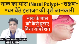 Nasal Polyps नाक के बढे हुए मांस का इलाज कैसे करे  Naak me Maas ka Badhna Nasal Polyps Treatment [upl. by Latona]