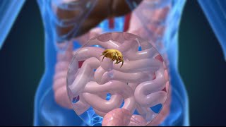 Les acariens  de nouveaux acteurs dans les maladies inflammatoires intestinales  video abstract [upl. by Ylak873]