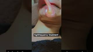 highfrequencyskincarecom reviews ultrasonic machine for facialultrasonic machine skintreatment [upl. by Einaj]