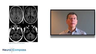 Risks of gadolinium accumulation in MRI [upl. by Cyprian]