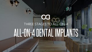 3 stages of ALL ON 4 Dental Implants with Dr Andrew Firgaira [upl. by Noswad]