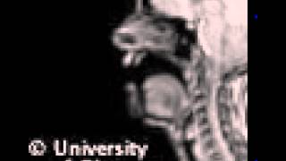 MRI uvular fricative [upl. by Llemhar]