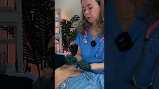 Asmr abdominal asmr satisfying asmrsounds asmrvideo relaxing medical oddlysatisfying relax [upl. by Ivett]