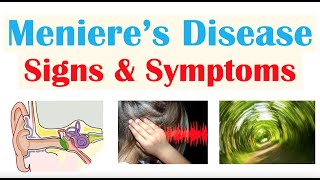 Meniere’s Disease Signs amp Symptoms amp Why They Occur [upl. by Lorna]