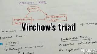 Virchows Triad  Revision seriesBasic sciences [upl. by Waneta294]