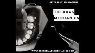 TipbackwithTPA  Essential Biomechanics [upl. by Barger]