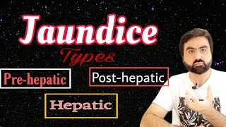 Jaundice  Types of Jaundice  Prehepatic  Hepatic  Posthepatic  UrduHindi [upl. by Egag]