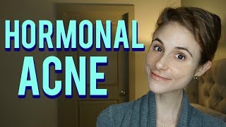 Hormonal acne Dr Dray QampA [upl. by Braswell184]