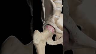 🦴 Hip Arthrosis When the Hip Joint Wears Down anatomy [upl. by Chaddie]