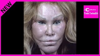 Jocelyn Wildenstein  La femme chat ruinée se déclare en banqueroute [upl. by Wolfgang]