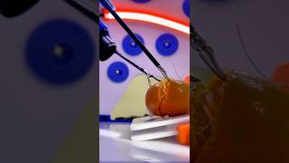 How laparoscopic surgery are done shortsvideo [upl. by Chip699]