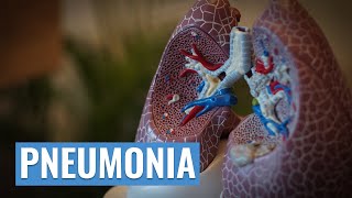 How does pneumonia affect the lungs [upl. by Leesen]