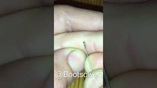 Huge splinter in my finger easily removed with pin and tweezers NO PAIN [upl. by Nomrah]