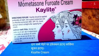 Kaylite Cream Use दाग धब्बे झुर्रियों में उपयोगी। [upl. by Ydorb487]