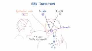 EBV and Mononucleosis  Pathogenesis and Clinical Presentation [upl. by Ajdan]