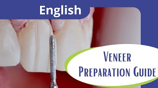 Veneer preparation guide [upl. by Haff597]