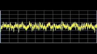 Flukes General  Rife Frequencies [upl. by Lacey]