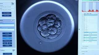 Embryoscope™  CREATE Fertility [upl. by Yanaton]