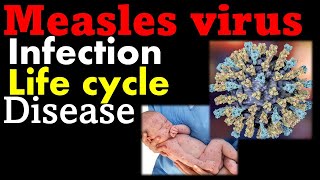 Measles virus  symptoms replication and treatment [upl. by Amme]