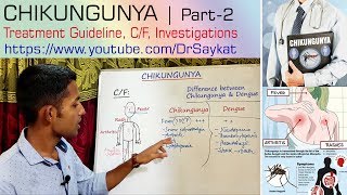 Chikungunya  Part 2  Treatment Guideline with Clinical features amp Investigations  Dr Saykat [upl. by Attey]