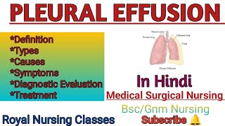 Pleural Effusion in Hindi pleuraleffusion [upl. by Annadal548]