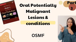 Oral Submucous Fibrosis  Oral Potentially Malignant Lesions amp Conditions  Oral Path  Part 2 [upl. by Romulus]