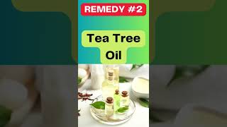 STOP Wasting Money On Dandruff Treatments Try Tea Tree Oil  Home Remedy Sanctuary  Natural Cures [upl. by Errehs]