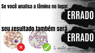 COMO ANALISAR UMA LÂMINA DE HEMATOLOGIA  MICROSCOPIA NO LUGAR CERTO [upl. by Maxey764]