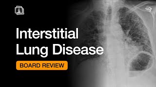 Interstitial Lung Disease  Chest Radiology Board Review [upl. by Niras19]