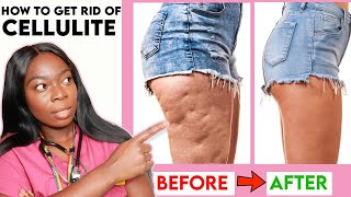 How to get rid of CELLULITE on your THIGHS LEGS amp BUTT Home Remedies Workout  Creams amp more [upl. by Rimaa]