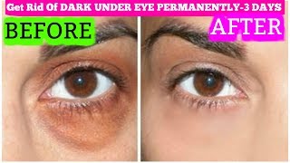 How To Get Rid Of Dark Circles In 3 Days Permanently  SuperPrincessjo [upl. by Notsle452]