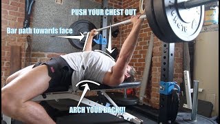 Should YOU Bench Press with Pectus Excavatum is it making it worse [upl. by Nerot]