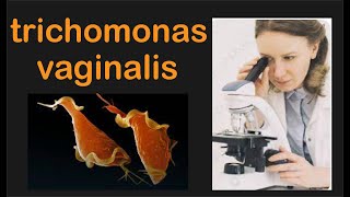 le trichomonas vaginalis  cours bien expliqué infirmier polyvalent deuxième année [upl. by Noremmac293]