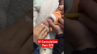 IV Cannulation  Part 575  Medical shorts viralvideo youtubeshorts nursery hospital [upl. by Bergren]