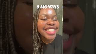 Watch in 12 months in prep for fix the beautiful🦷beadrepaircheapsavemoneyfillfixkits [upl. by Natalee104]