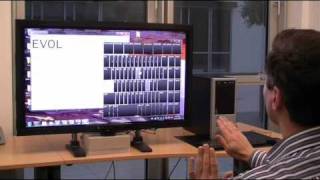 Kinect Treatment of Windows 7 [upl. by Ulphiah586]