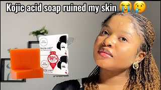 Stop using kojie San soapkojie San soap review kojic acid soapkojie San skin lightening soap [upl. by Allerbag]