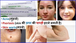 SALICYLIC ACID OINTMENT का यूज कब और कैसे किया जाता हैSALICYLIC ACID CREAM USESPIMPLESACNECREAM [upl. by Direj381]