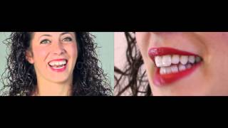 Faccette dentali  Veneers [upl. by Erual482]