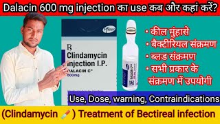 Clindamycin injectionuse कब और कहां करें पूरी जानकारीDalacin c 600mg injectionuseDosewarningquot [upl. by Nojad]