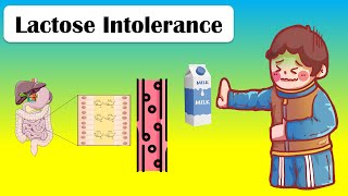 Lactose Intolerance  Types Causes Pathophysiology Signs amp Symptoms And Treatment [upl. by Ainigriv776]