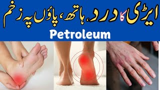 PETROLEUM  HEEL PAIN IN WOMEN  ECZEMA IN WINTER  AURTO MAIN EREY KA DARD  By Dr Tuqeer Akbar [upl. by Jarid]