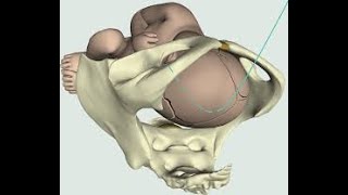 Mechanism of Labour ROA [upl. by Eirual232]