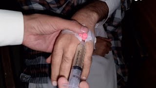 Give CEFOTAXIME Injection Through a Cannula Safely [upl. by Enifesoj801]