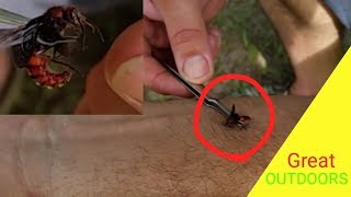 FLYING COW KILLER STING TEST The Velvet Ant [upl. by Lleihsad]