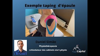 Présentation dun taping de lépaule [upl. by Jordon736]