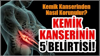 Kemik kanserinin 5 belirtisi Kemik tümörü nedir kemik kanseri belirtileri nelerdir [upl. by Heppman993]