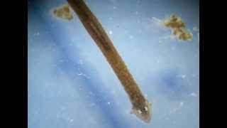 Planaria Phylum Platyhelminthes [upl. by Halika802]