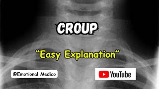 Croup  Acute LaryngoTracheoBronchitis  ENT  emotionalmedico [upl. by Brindell816]